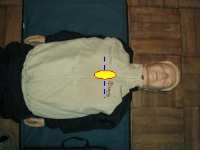 AED06